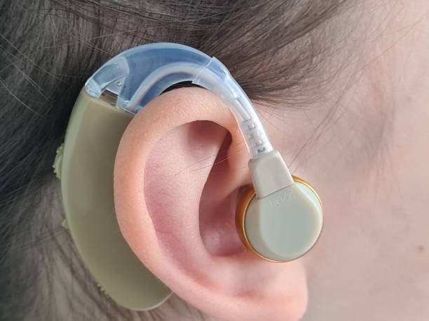 Exploring the Cost of Hearing Aids: What You Need to Know